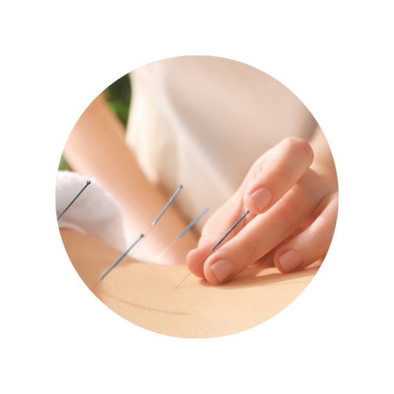 Medical Acupuncture Hatfield